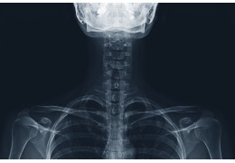 Musculoskeletal strain in dentists: electromyographic and goniometric study