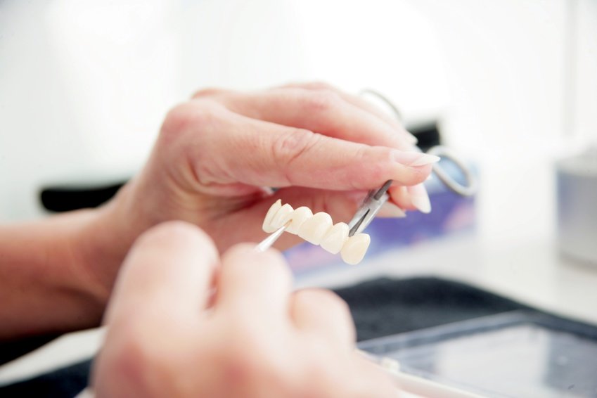 Design parameters for all-ceramic dental crowns